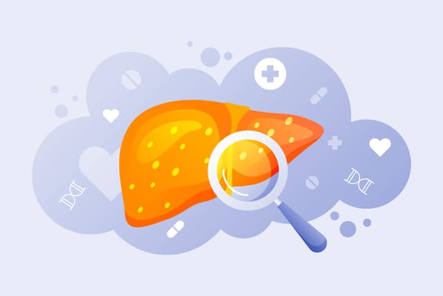 Is My Liver Healthy?