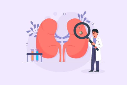  Am I At The Risk Of Kidney Stone?