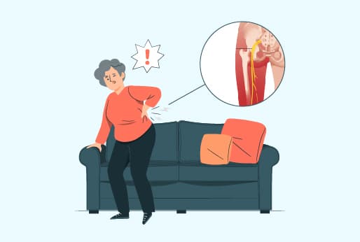 Am I Experiencing Sciatica Pain? 