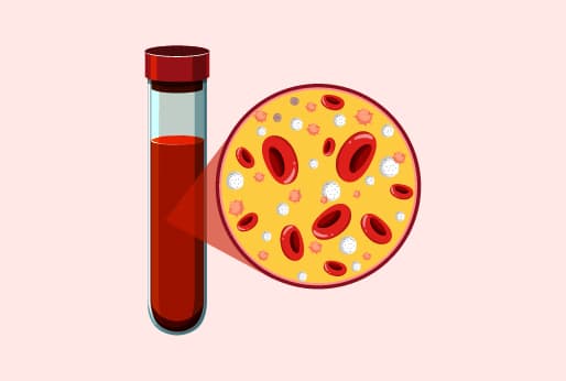 Am I At The Risk For Having Thalassemia?