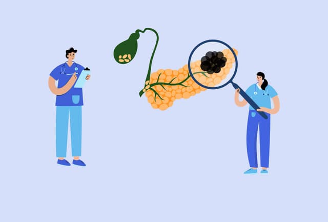 Am I At The Risk Of  Gall Stone (Cholelithiasis)?