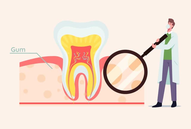 Do I Have Healthy Gums?