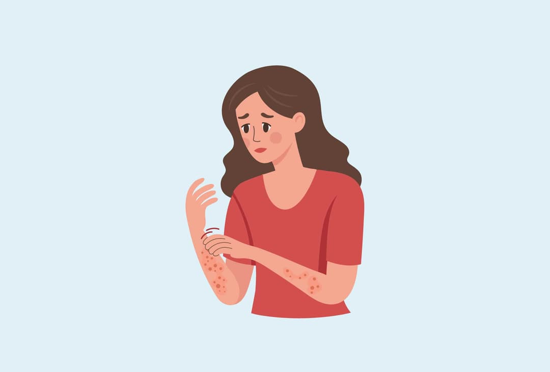 Am I At Risk Of Fungal Infection?