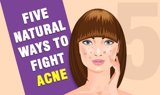 Homemade Face Packs To Fight Acne