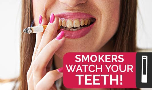 Smokers Watch Your Teeth!