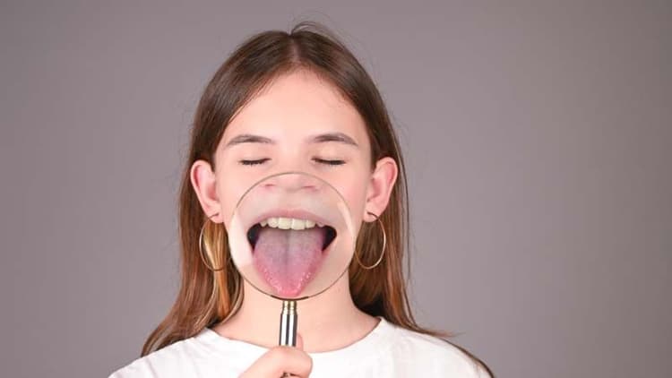 Check What Your Tongue Color Says About You